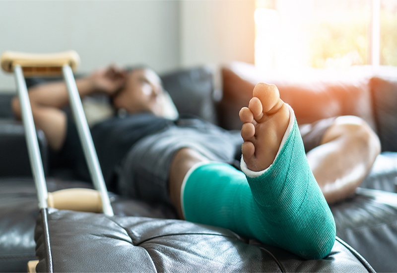 Beamten Beratung online Bild gebrochenes Bein